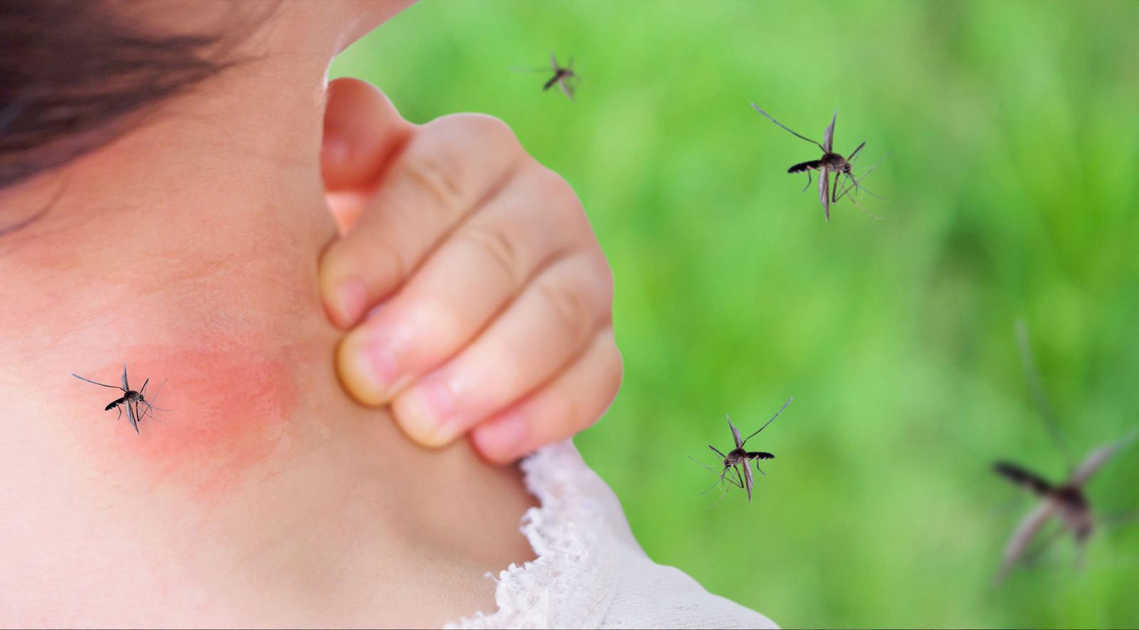 Insektenstiche: Schützen Sie sich im Vorfeld, um eine Behandlung zu verhindern 